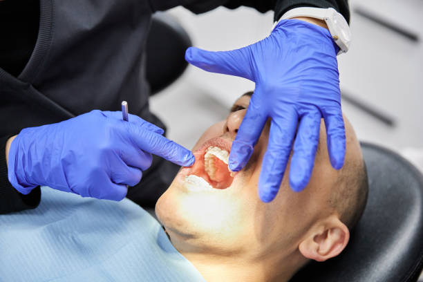 Best Broken Tooth Emergency  in Hemlock, MI